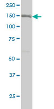 ITGA2 monoclonal antibody (M01), clone 2B6