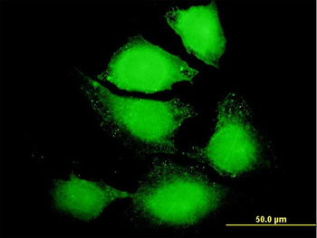 IL6 purified MaxPab mouse polyclonal antibody (B01P)