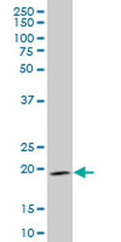 IHH monoclonal antibody (M01), clone 2G9