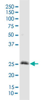 IGFBP3 purified MaxPab rabbit polyclonal antibody (D01P)