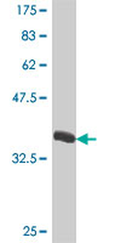 IFI27 polyclonal antibody (A01)