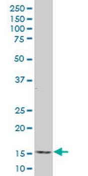ID2 monoclonal antibody (M04), clone 2C11