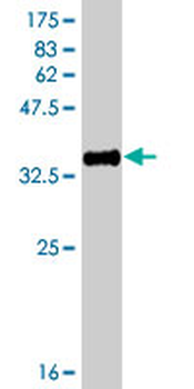 HSD17B3 polyclonal antibody (A01)