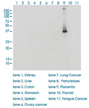 HSD3B1 monoclonal antibody (M01), clone 3C11-D4