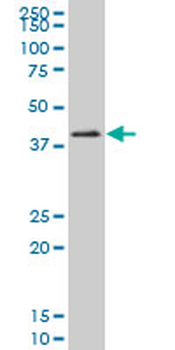 HOXC10 polyclonal antibody (A02)