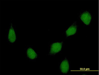 HOXB7 purified MaxPab rabbit polyclonal antibody (D01P)