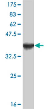 FOXA1 monoclonal antibody (M01), clone 2D7