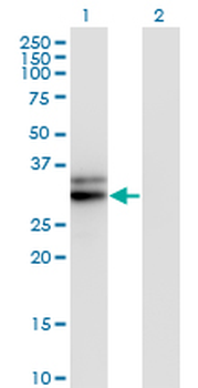 HMGCL monoclonal antibody (M01), clone 4F4-D1