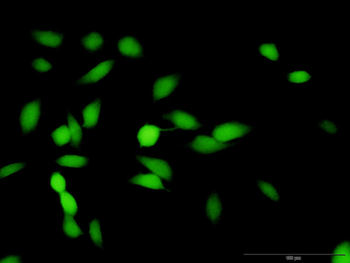 HMBS purified MaxPab rabbit polyclonal antibody (D01P)
