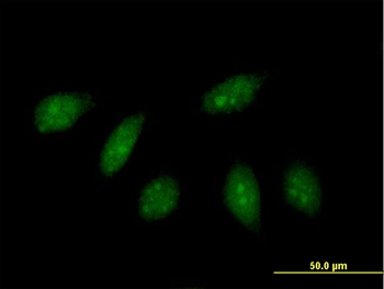 HLX purified MaxPab mouse polyclonal antibody (B01P)