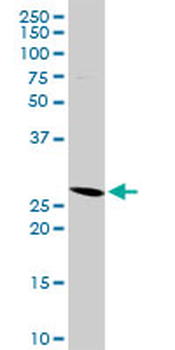 HLA-DMA purified MaxPab rabbit polyclonal antibody (D01P)