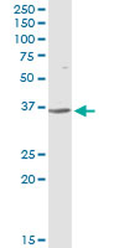 CFHR1 purified MaxPab rabbit polyclonal antibody (D01P)