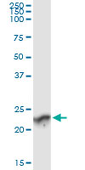 GUK1 monoclonal antibody (M01), clone 4C3-1A7
