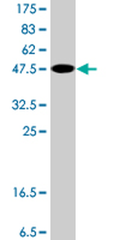 GUK1 polyclonal antibody (A01)