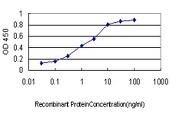 GTF2I monoclonal antibody (M01), clone 3E2