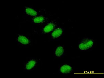 GTF2E1 MaxPab mouse polyclonal antibody (B01)