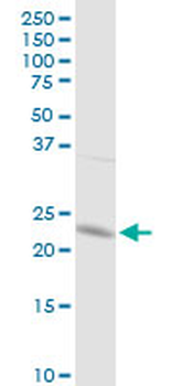 GSTP1 purified MaxPab rabbit polyclonal antibody (D01P)