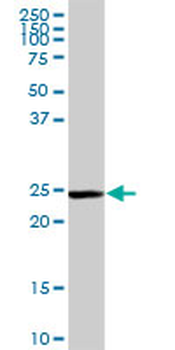 GSTM5 purified MaxPab rabbit polyclonal antibody (D01P)