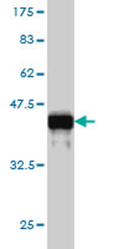 GSN monoclonal antibody (M01), clone 3G5