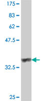 GRID1 polyclonal antibody (A01)