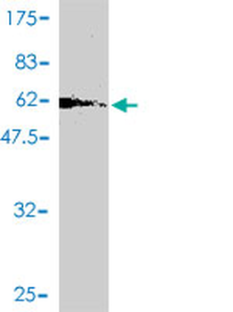 GPD2 polyclonal antibody (A01)