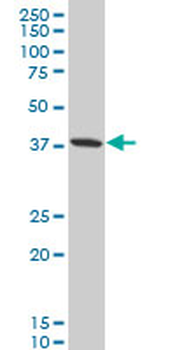GOT2 polyclonal antibody (A01)