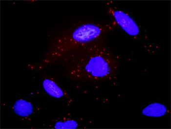 GNAS purified MaxPab rabbit polyclonal antibody (D01P)