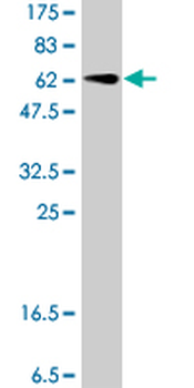 GNAI1 polyclonal antibody (A01)