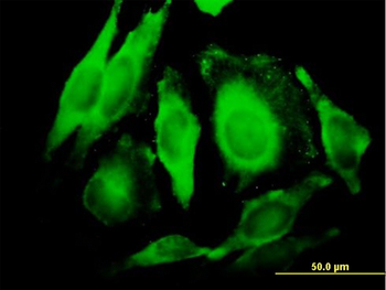 GGT1 purified MaxPab mouse polyclonal antibody (B01P)