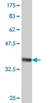GBE1 polyclonal antibody (A01)