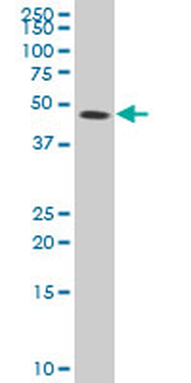 GABPB2 polyclonal antibody (A01)