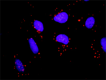 FYN monoclonal antibody (M01), clone 3G11-F9