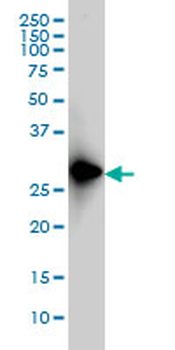 FRG1 monoclonal antibody (M01), clone 4A5