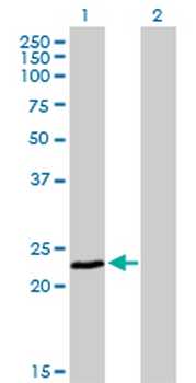 FXN monoclonal antibody (M03), clone 3G9