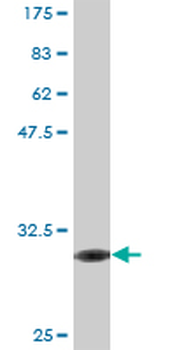 FPR2 monoclonal antibody (M02), clone 2D8