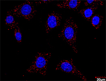 FLT1 purified MaxPab rabbit polyclonal antibody (D01P)