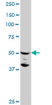FLI1 monoclonal antibody (M06), clone 2D6