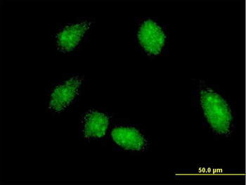 FLI1 monoclonal antibody (M05), clone 1F6