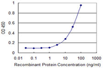 FOXM1 monoclonal antibody (M09), clone 1D3