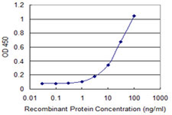 FOXM1 monoclonal antibody (M07), clone 2E2