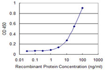 FOXM1 monoclonal antibody (M05), clone 2H4