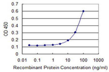 FOXC2 monoclonal antibody (M04), clone 1A8