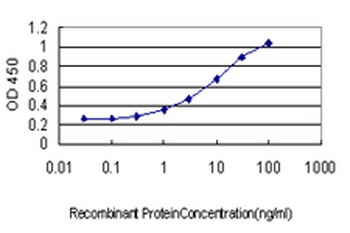 FOXC2 monoclonal antibody (M02), clone 2H3