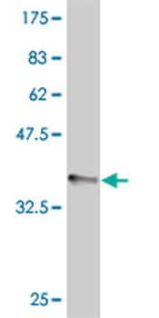 FOXJ1 monoclonal antibody (M01), clone 5B2