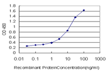 FOXF2 monoclonal antibody (M08), clone 3D11