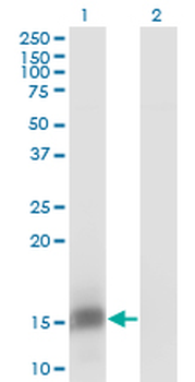 FKBP1B monoclonal antibody (M01), clone 4H5-1B6
