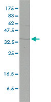 FHL2 monoclonal antibody (M01), clone 2G3-1A5