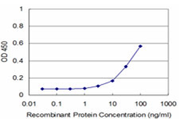 FHIT monoclonal antibody (M07), clone 1H2