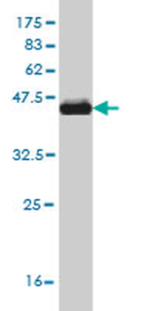 FGFR1 monoclonal antibody (M04), clone 3C8