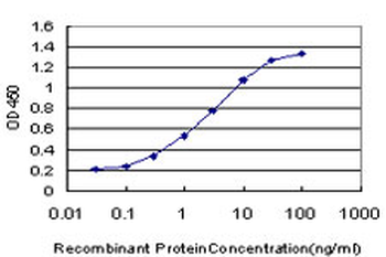 FGFR1 monoclonal antibody (M03), clone 5E9